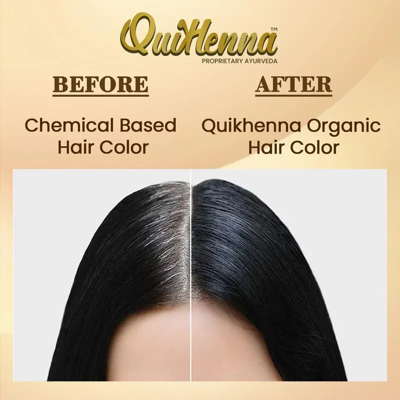 Organic Hair Colour Gel 4N - PPD & Ammonia Free Permanent Natural Hair Color, 100% Grey Coverage, Long Lasting Gel Colour for Men & Women, 120gm 1 Count (Pack of 1) Medium Brown