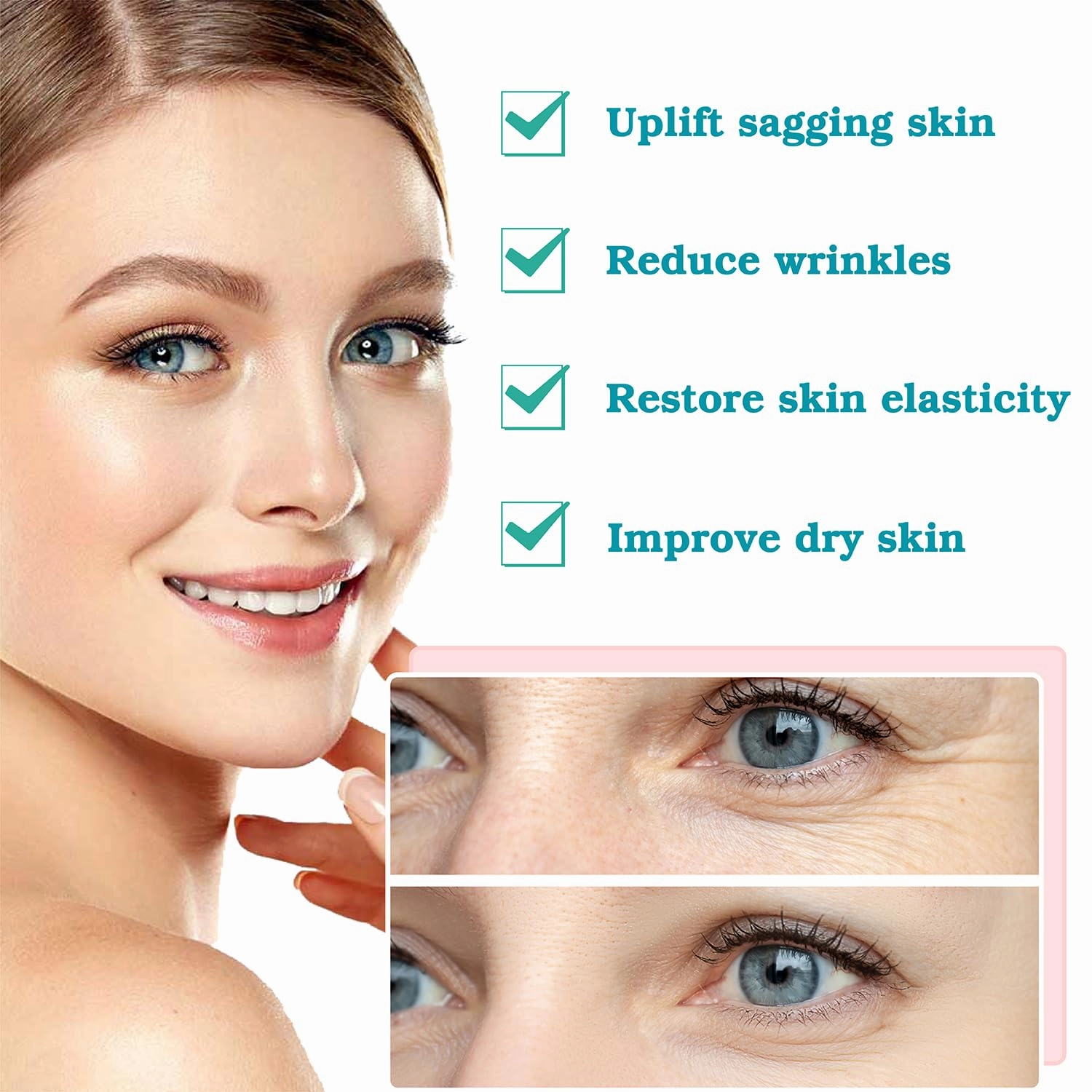 Pdo Threads for Face Lift Mono Screw Type (26G60MM) Smoothing Wrinkles PDO Thread Lift for Whole Body with Sharp Tip 20pcs