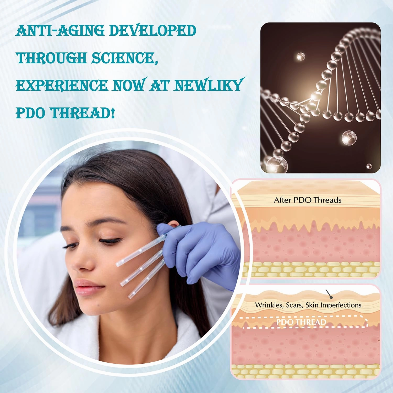 Pdo Threads for Face Lift Mono Screw Type (26G60MM) Smoothing Wrinkles PDO Thread Lift for Whole Body with Sharp Tip 20pcs