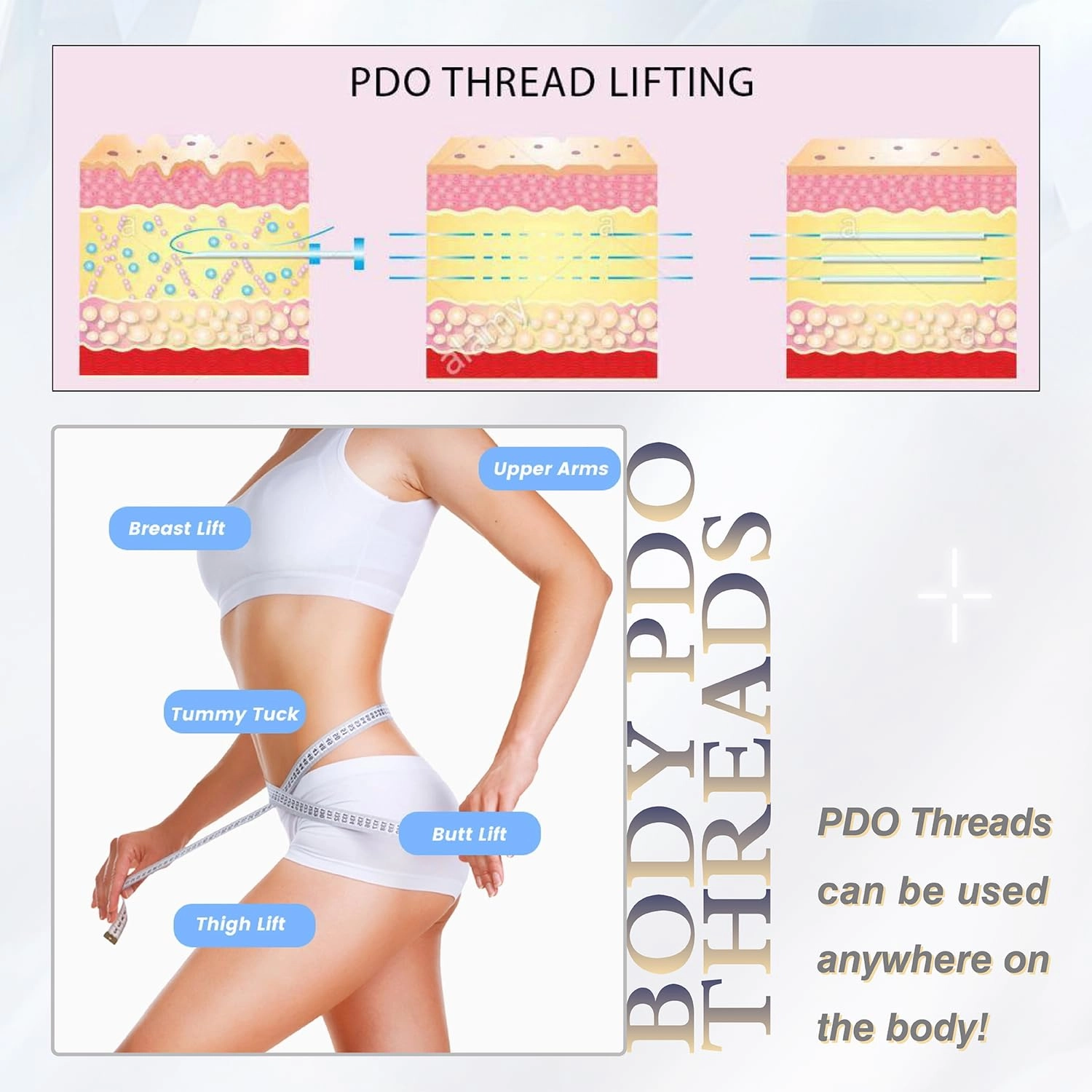 Pdo Threads for Face Lift Mono Screw Type (26G60MM) Smoothing Wrinkles PDO Thread Lift for Whole Body with Sharp Tip 20pcs