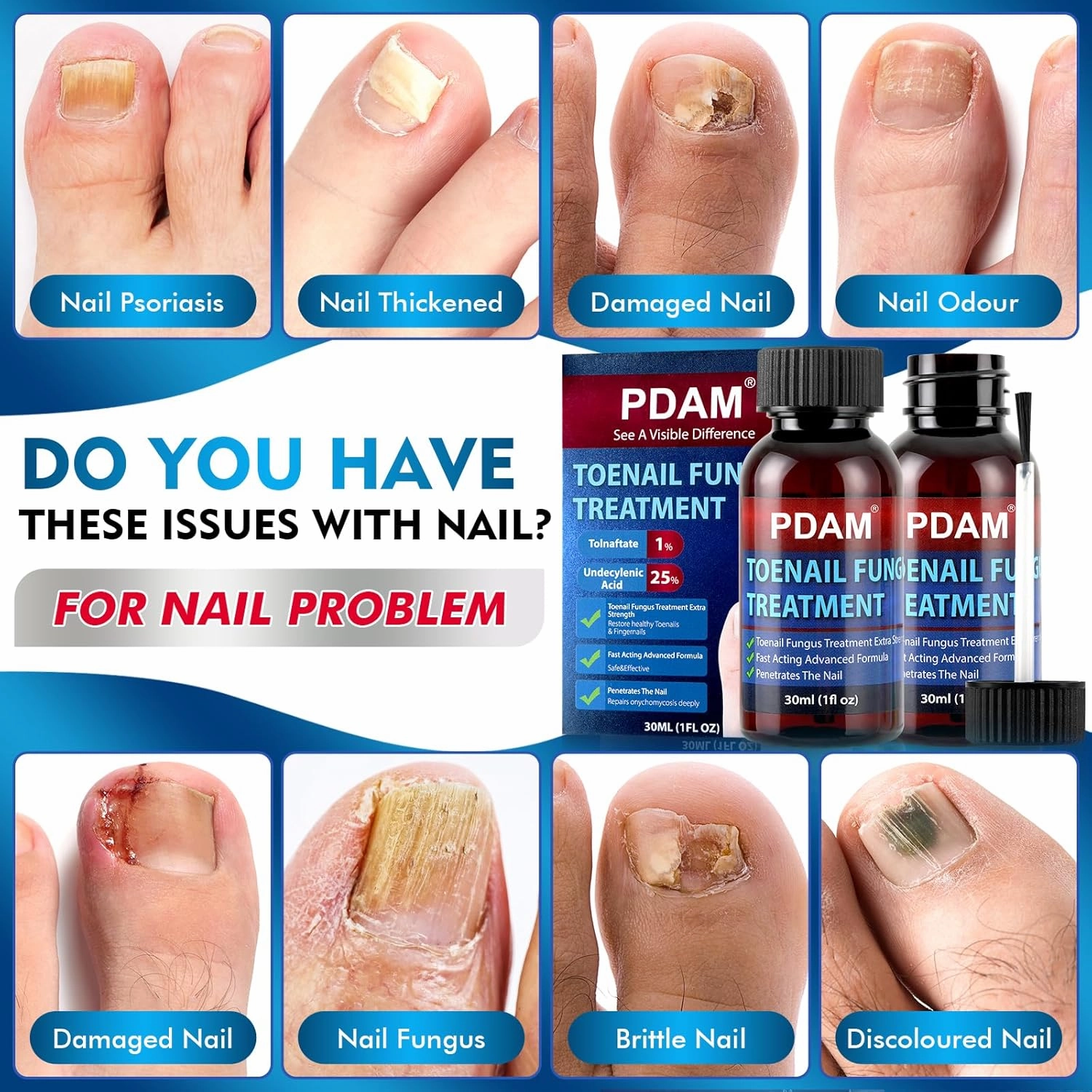 Toenail Fungus Treatment Extra Strength - Toe Nail Fungus Treatments for Thick, Nail Strengthener and Growth, Nail Fungus Treatment Extra Strength for Broken, Discolored Nail & Ingrown Toenail - 60ml