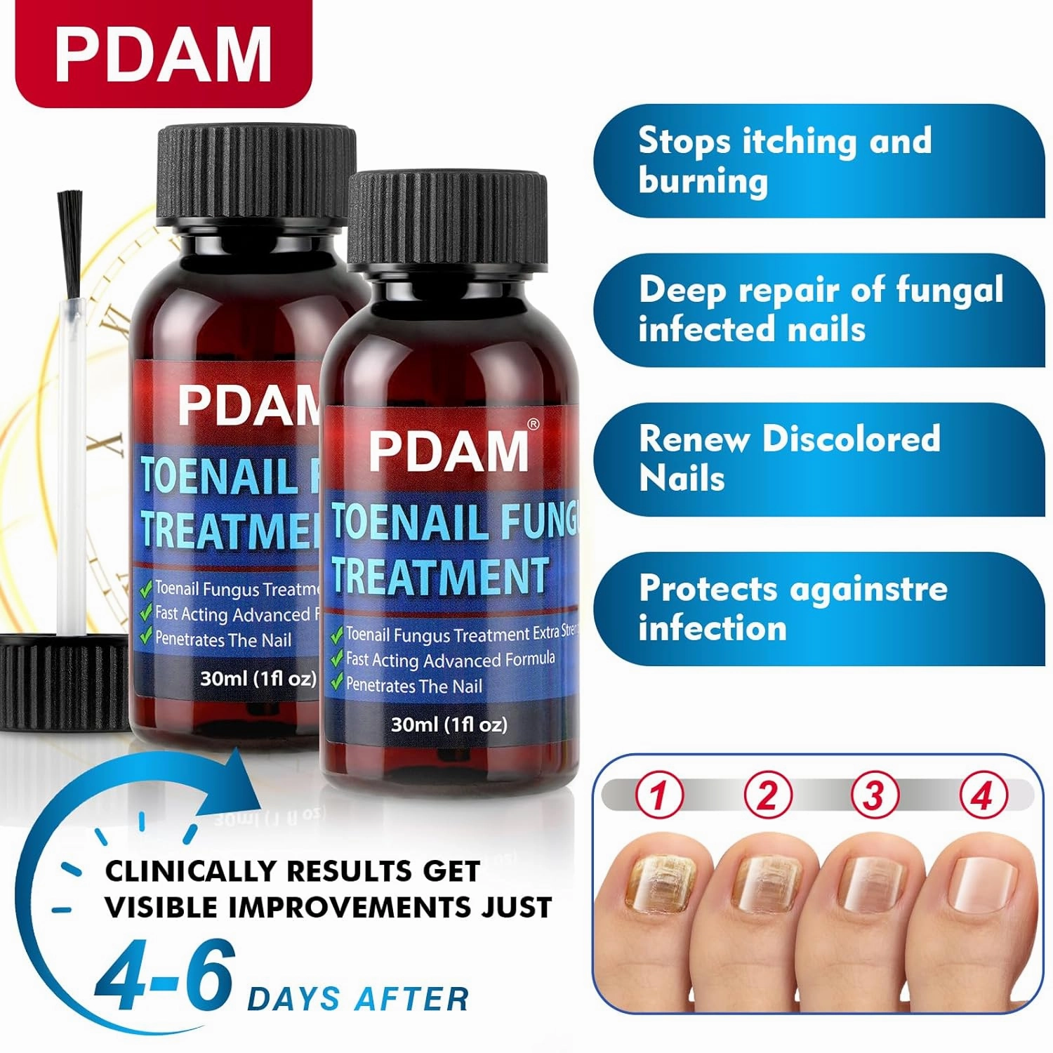 Toenail Fungus Treatment Extra Strength - Toe Nail Fungus Treatments for Thick, Nail Strengthener and Growth, Nail Fungus Treatment Extra Strength for Broken, Discolored Nail & Ingrown Toenail - 60ml